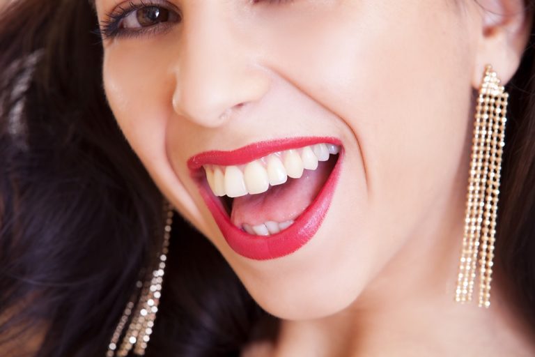 sourire parfait