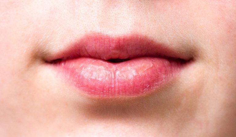 prendre soin de ses lèvres bouche astuces conseils visage