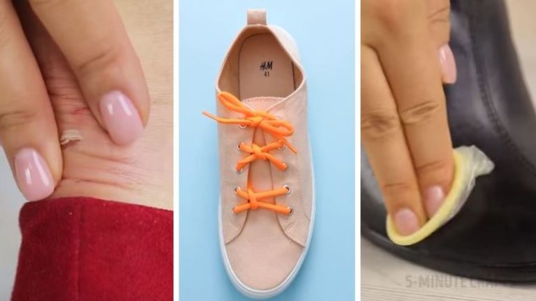 problèmes de chaussures astuces