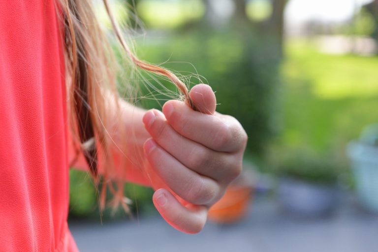 chute de cheveux aliments manger remède naturel