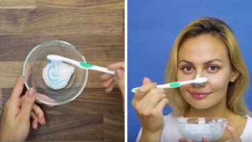 éliminer ses points noirs