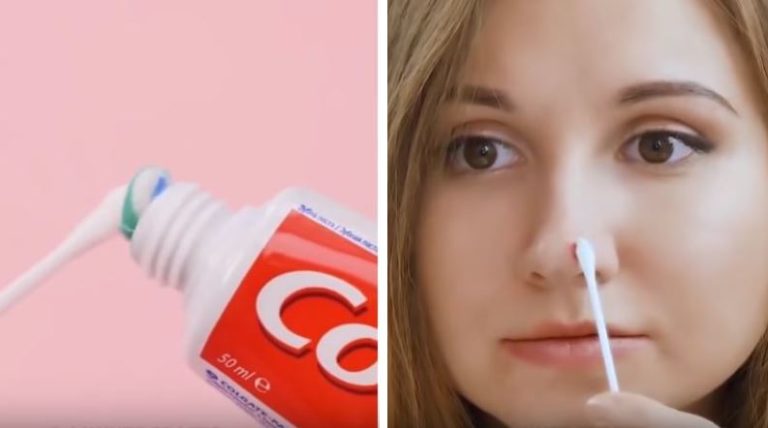bouton d'acné utilisations dentifrice