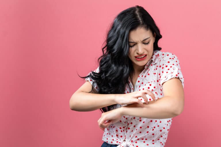 femme piqûre de moustique se gratter démangeaison peau