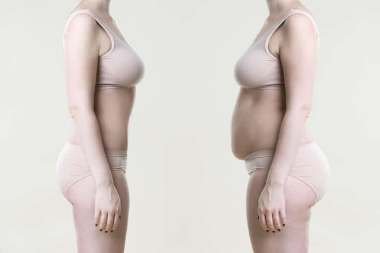 régime avant après femme corps minceur perdre poids kilos corps