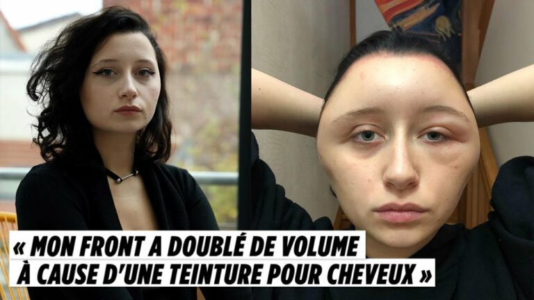 coloration capillaire cheveux femme allergie