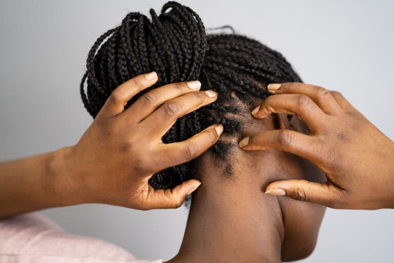 femme noire gratter cheveux démangeaison masser crâne tresses cuir chevelu irrité