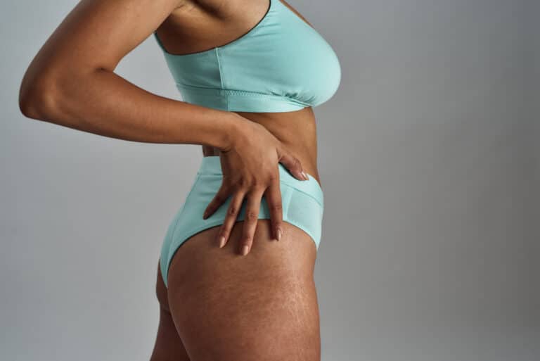femme noire vergetures peau sous vêtements lingerie corps