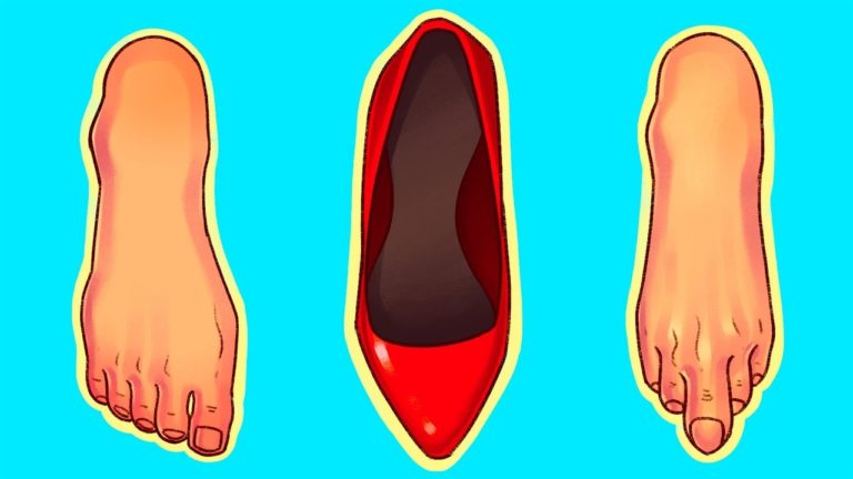 mal aux pieds talons
