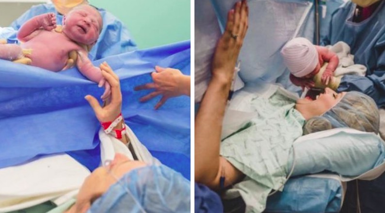 accouchement par césarienne photos