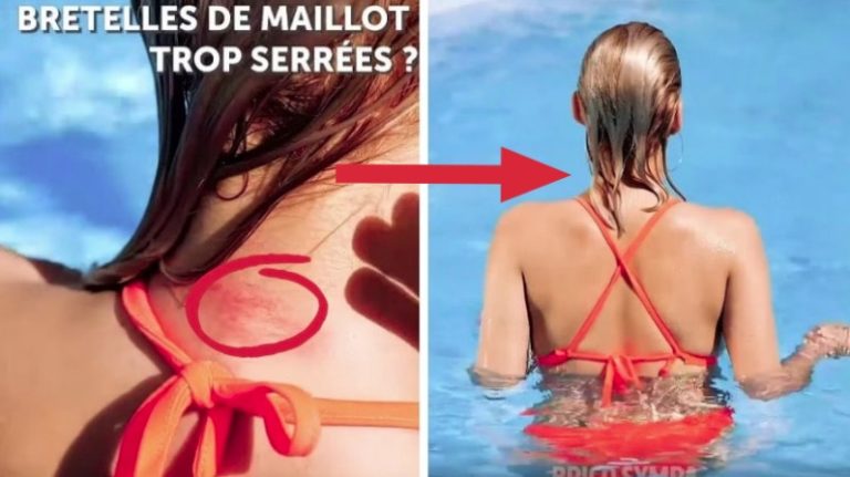 bretelles de maillot de bain trop serrées astuces été