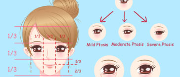 femme paupières tombantes astuces exercices