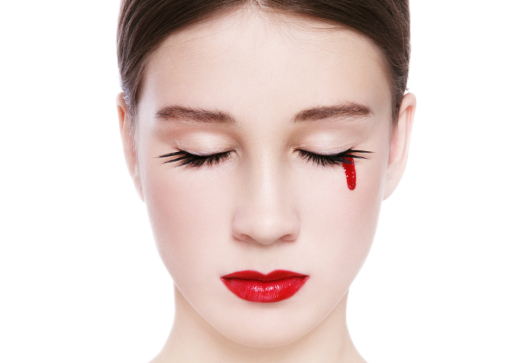 femme règles pleurer larmes sang hémolacrie menstruation vicariante