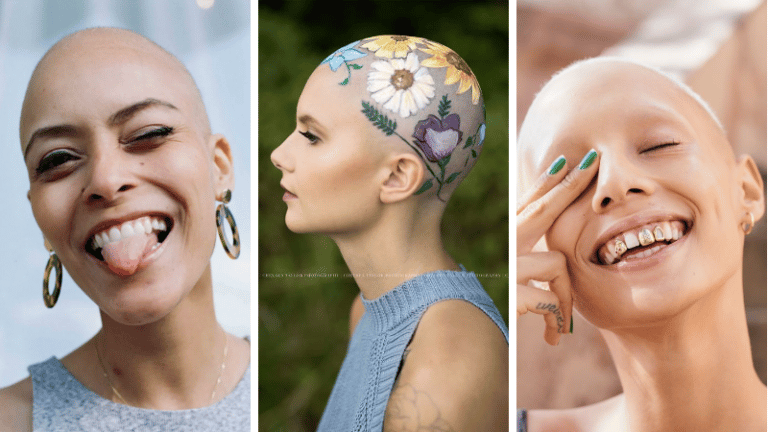 cancer du sein chimio femmes photos crâne chauve