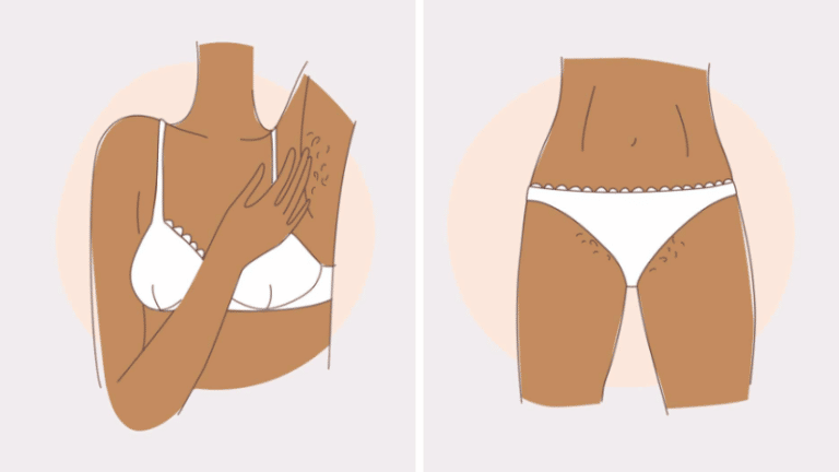 ralentir repousse aisselles poils jambes maillot astuces épilation